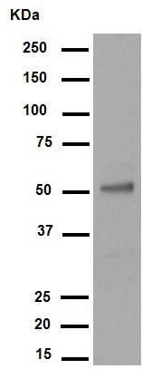 Western blot - Anti-Wilms Tumor Protein antibody [CAN-R9(IHC)-56-2] (ab89901), expandable thumbnail