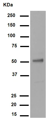 Western blot - Anti-Wilms Tumor Protein antibody [CAN-R9(IHC)-56-2] (AB89901)
