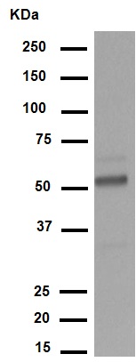 Western blot - Anti-Wilms Tumor Protein antibody [CAN-R9(IHC)-56-2] (ab89901), expandable thumbnail