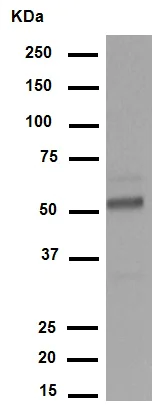 Western blot - Anti-Wilms Tumor Protein antibody [CAN-R9(IHC)-56-2] (AB89901)