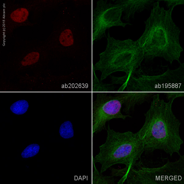 Immunocytochemistry/ Immunofluorescence - Anti-Wilms Tumor Protein antibody [CAN-R9(IHC)-56-2] - BSA and Azide free (AB216646), expandable thumbnail