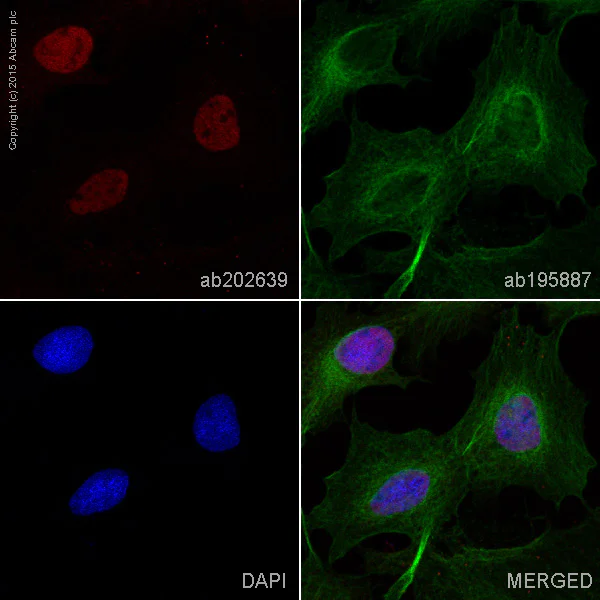 Immunocytochemistry/ Immunofluorescence - Anti-Wilms Tumor Protein antibody [CAN-R9(IHC)-56-2] - BSA and Azide free (AB216646)