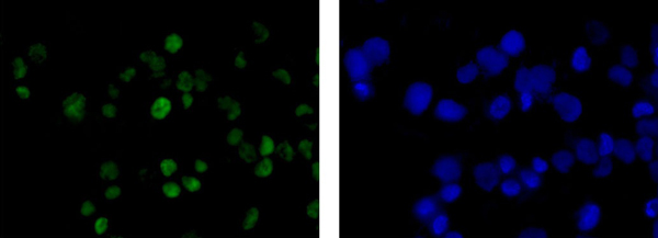 Immunocytochemistry/ Immunofluorescence - Anti-Wilms Tumor Protein antibody [CAN-R9(IHC)-56-2] - BSA and Azide free (ab216646), expandable thumbnail