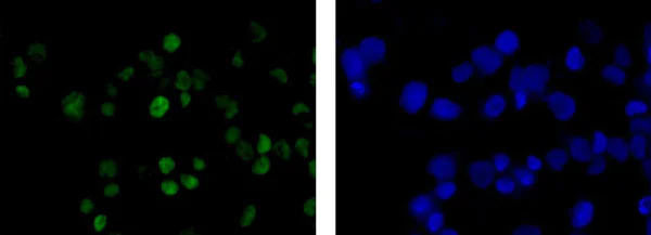 Immunocytochemistry/ Immunofluorescence - Anti-Wilms Tumor Protein antibody [CAN-R9(IHC)-56-2] - BSA and Azide free (AB216646)