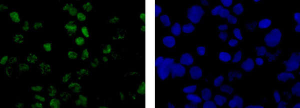 Immunocytochemistry/ Immunofluorescence - Anti-Wilms Tumor Protein antibody [CAN-R9(IHC)-56-2] - BSA and Azide free (ab216646), expandable thumbnail