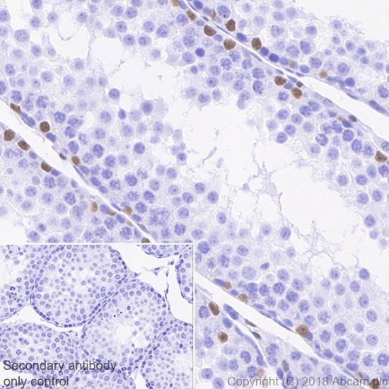 Immunohistochemistry (Formalin/PFA-fixed paraffin-embedded sections) - Anti-Wilms Tumor Protein antibody [CAN-R9(IHC)-56-2] - BSA and Azide free (AB216646), expandable thumbnail