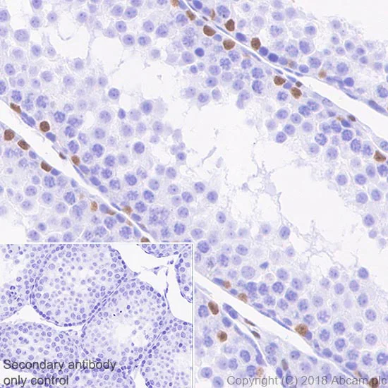 Immunohistochemistry (Formalin/PFA-fixed paraffin-embedded sections) - Anti-Wilms Tumor Protein antibody [CAN-R9(IHC)-56-2] - BSA and Azide free (AB216646)