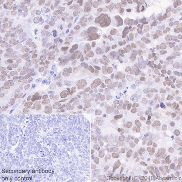 Immunohistochemistry (Formalin/PFA-fixed paraffin-embedded sections) - Anti-Wilms Tumor Protein antibody [CAN-R9(IHC)-56-2] - BSA and Azide free (AB216646), expandable thumbnail