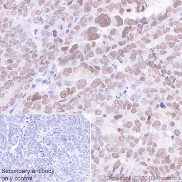 Immunohistochemistry (Formalin/PFA-fixed paraffin-embedded sections) - Anti-Wilms Tumor Protein antibody [CAN-R9(IHC)-56-2] - BSA and Azide free (AB216646)