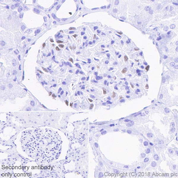 Immunohistochemistry (Formalin/PFA-fixed paraffin-embedded sections) - Anti-Wilms Tumor Protein antibody [CAN-R9(IHC)-56-2] - BSA and Azide free (ab216646), expandable thumbnail