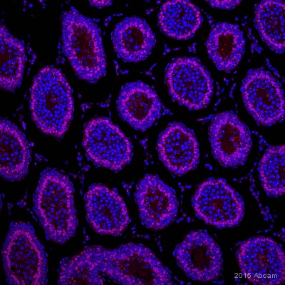 Immunohistochemistry (Formalin/PFA-fixed paraffin-embedded sections) - Anti-Wilms Tumor Protein antibody [CAN-R9(IHC)-56-2] - BSA and Azide free (ab216646), expandable thumbnail