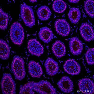 Immunohistochemistry (Formalin/PFA-fixed paraffin-embedded sections) - Anti-Wilms Tumor Protein antibody [CAN-R9(IHC)-56-2] - BSA and Azide free (AB216646)