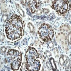 Immunohistochemistry (Formalin/PFA-fixed paraffin-embedded sections) - Anti-Wilms Tumor Protein antibody [CAN-R9(IHC)-56-2] - BSA and Azide free (ab216646), expandable thumbnail