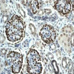 Immunohistochemistry (Formalin/PFA-fixed paraffin-embedded sections) - Anti-Wilms Tumor Protein antibody [CAN-R9(IHC)-56-2] - BSA and Azide free (AB216646)