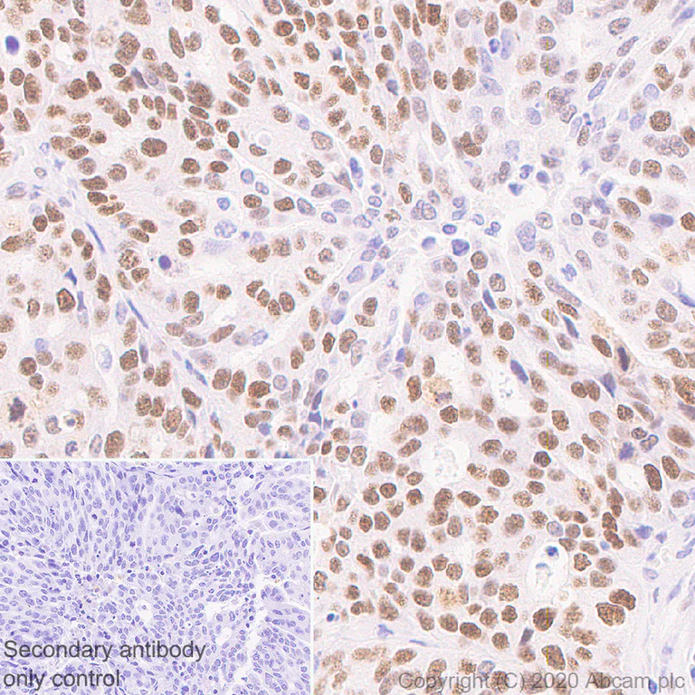 Immunohistochemistry (Formalin/PFA-fixed paraffin-embedded sections) - Anti-Wilms Tumor Protein antibody [EPR23963-116] (AB267377)