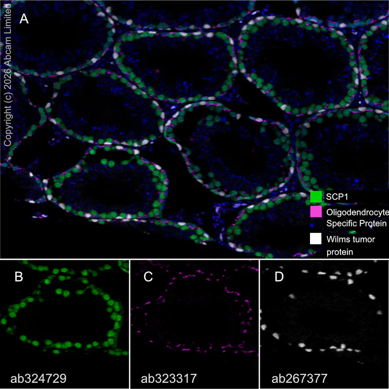 Multiplex immunohistochemistry - Anti-Wilms Tumor Protein antibody [EPR23963-116] (AB267377)