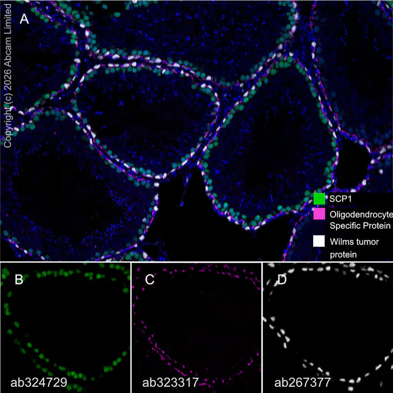 Multiplex immunohistochemistry - Anti-Wilms Tumor Protein antibody [EPR23963-116] (AB267377)
