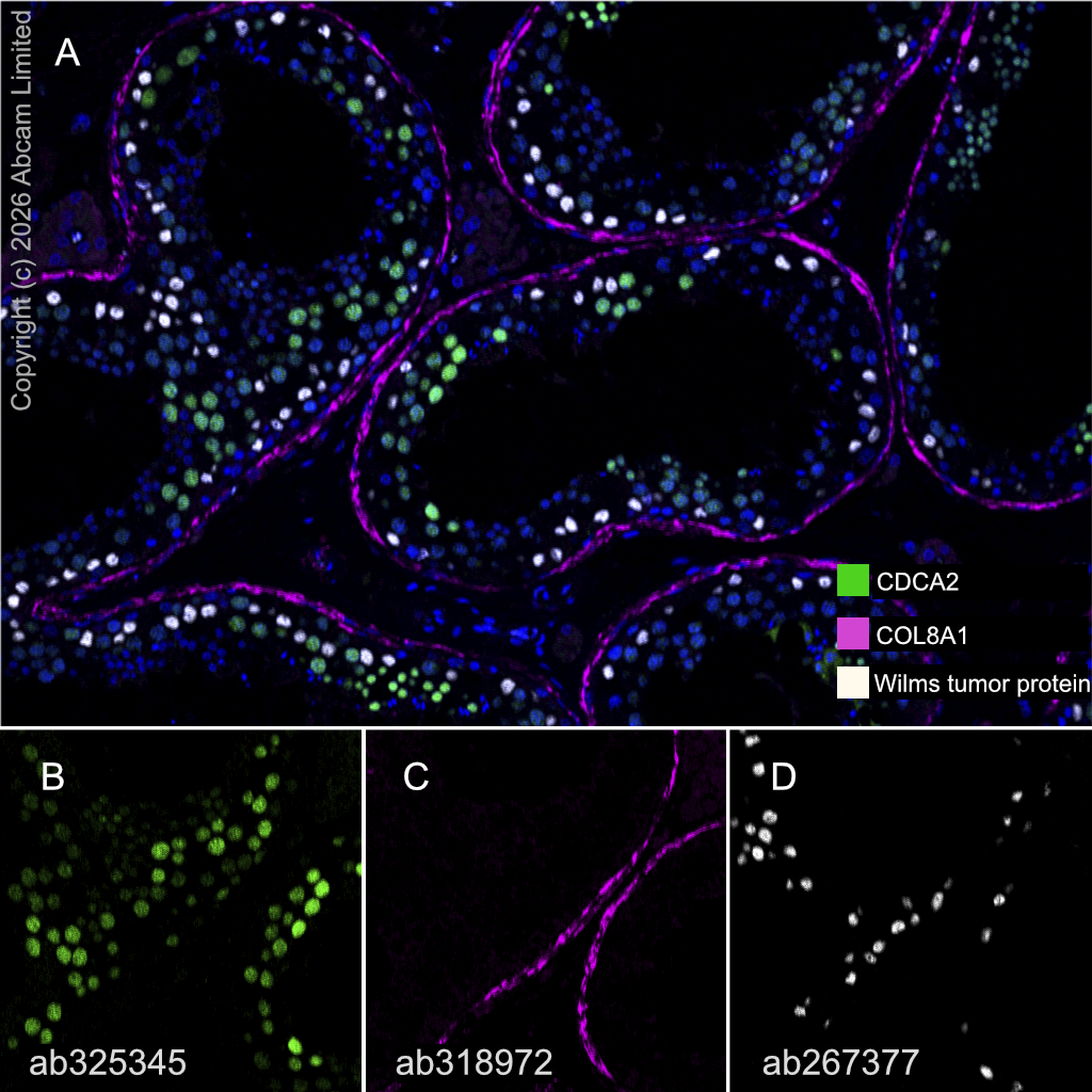 Multiplex immunohistochemistry - Anti-Wilms Tumor Protein antibody [EPR23963-116] (AB267377)