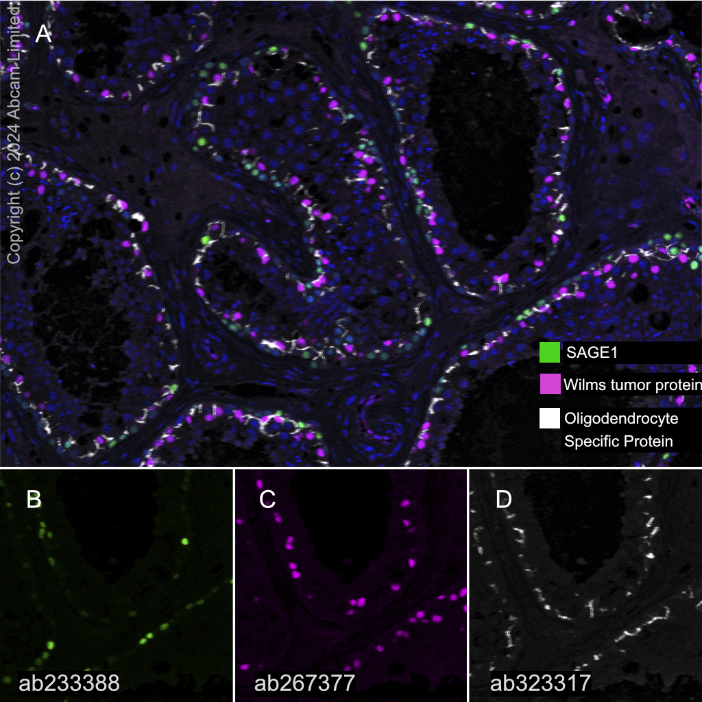 Multiplex immunohistochemistry - Anti-Wilms Tumor Protein antibody [EPR23963-116] (AB267377)