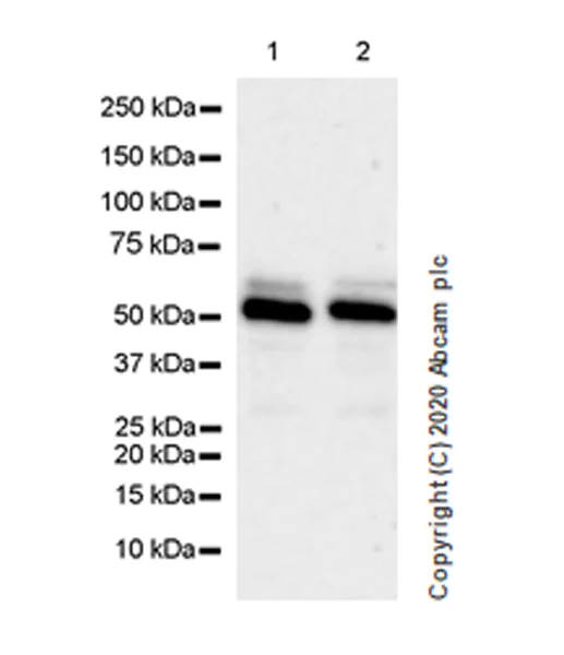 Western blot - Anti-Wilms Tumor Protein antibody [EPR23963-116] (AB267377)