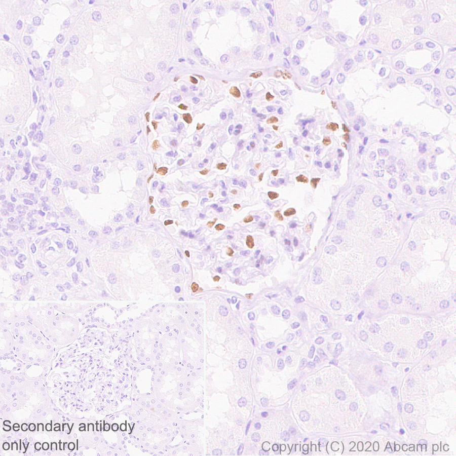 Immunohistochemistry (Formalin/PFA-fixed paraffin-embedded sections) - Anti-Wilms Tumor Protein antibody [EPR23963-116] - BSA and Azide free (AB275970), expandable thumbnail