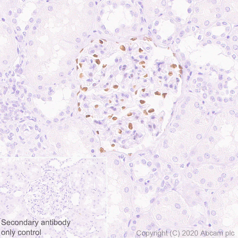 Immunohistochemistry (Formalin/PFA-fixed paraffin-embedded sections) - Anti-Wilms Tumor Protein antibody [EPR23963-116] - BSA and Azide free (AB275970)
