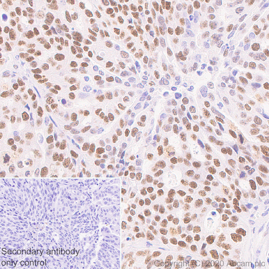 Immunohistochemistry (Formalin/PFA-fixed paraffin-embedded sections) - Anti-Wilms Tumor Protein antibody [EPR23963-116] - BSA and Azide free (ab275970), expandable thumbnail