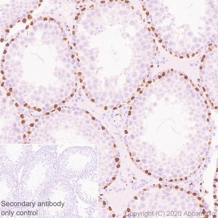 Immunohistochemistry (Formalin/PFA-fixed paraffin-embedded sections) - Anti-Wilms Tumor Protein antibody [EPR23963-116] - BSA and Azide free (AB275970)
