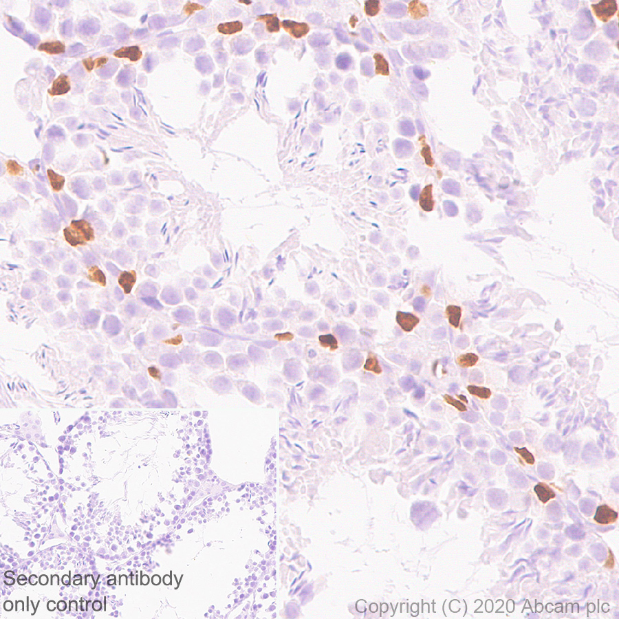 Immunohistochemistry (Formalin/PFA-fixed paraffin-embedded sections) - Anti-Wilms Tumor Protein antibody [EPR23963-116] - BSA and Azide free (AB275970), expandable thumbnail