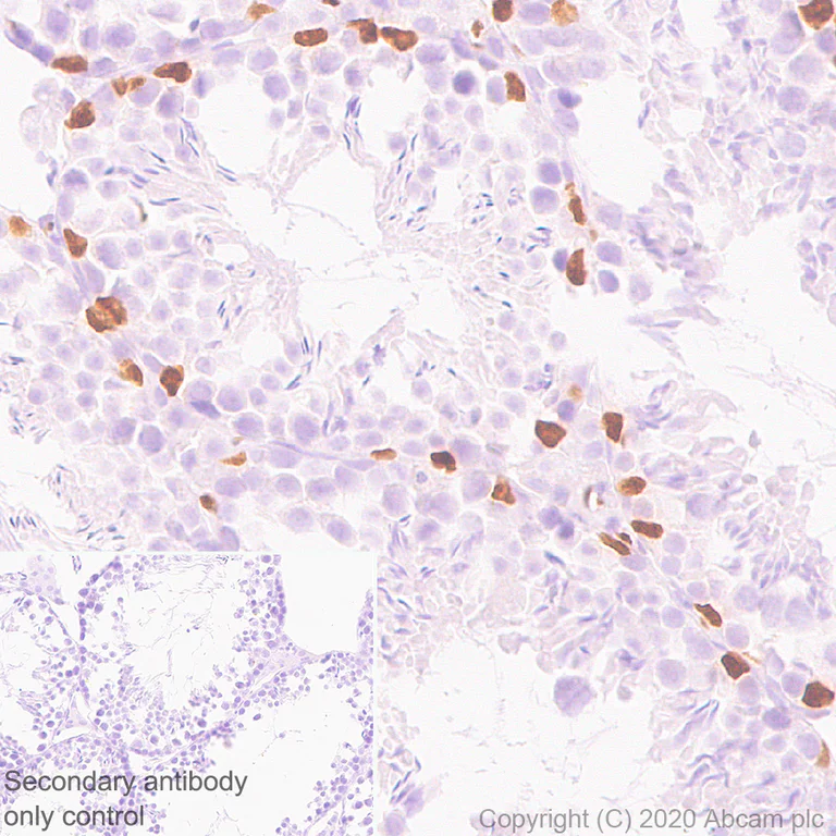 Immunohistochemistry (Formalin/PFA-fixed paraffin-embedded sections) - Anti-Wilms Tumor Protein antibody [EPR23963-116] - BSA and Azide free (AB275970)
