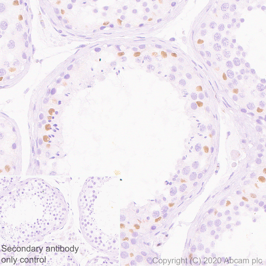 Immunohistochemistry (Formalin/PFA-fixed paraffin-embedded sections) - Anti-Wilms Tumor Protein antibody [EPR23963-116] - BSA and Azide free (ab275970), expandable thumbnail