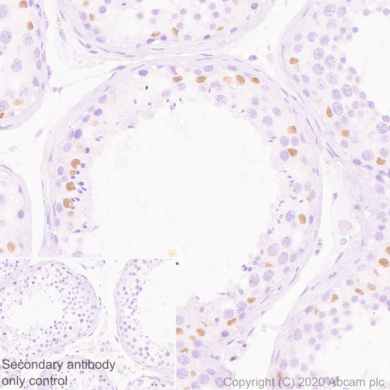 Immunohistochemistry (Formalin/PFA-fixed paraffin-embedded sections) - Anti-Wilms Tumor Protein antibody [EPR23963-116] - BSA and Azide free (AB275970)