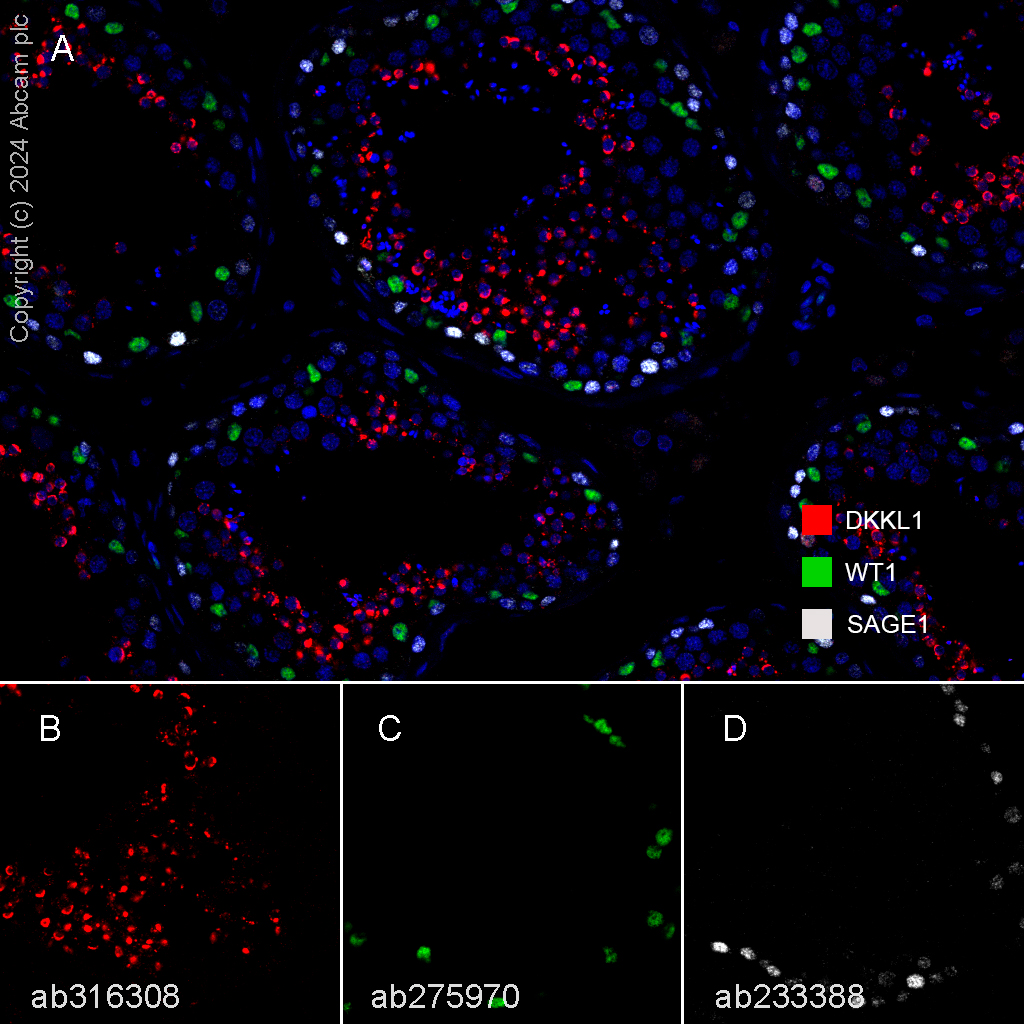 Multiplex immunohistochemistry - Anti-Wilms Tumor Protein antibody [EPR23963-116] - BSA and Azide free (ab275970), expandable thumbnail