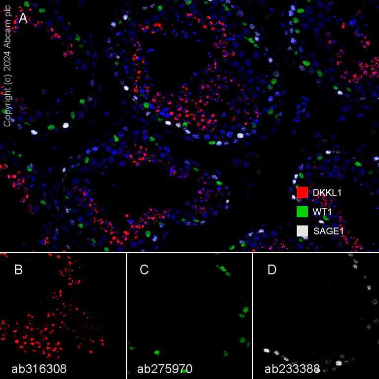 Multiplex immunohistochemistry - Anti-Wilms Tumor Protein antibody [EPR23963-116] - BSA and Azide free (AB275970)