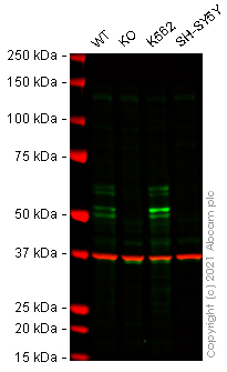 Western blot - Anti-Wilms Tumor Protein antibody [EPR23963-116] - BSA and Azide free (AB275970), expandable thumbnail