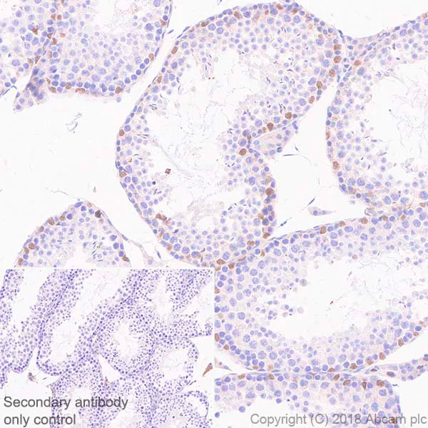 Immunohistochemistry (Formalin/PFA-fixed paraffin-embedded sections) - Anti-Wilms Tumor Protein antibody [SP320] - BSA and Azide free (AB242423)