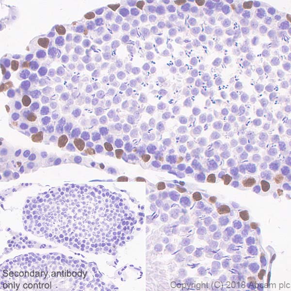 Immunohistochemistry (Formalin/PFA-fixed paraffin-embedded sections) - Anti-Wilms Tumor Protein antibody [SP320] - BSA and Azide free (AB242423), expandable thumbnail