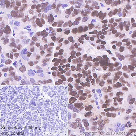 Immunohistochemistry (Formalin/PFA-fixed paraffin-embedded sections) - Anti-Wilms Tumor Protein antibody [SP320] - BSA and Azide free (AB242423), expandable thumbnail
