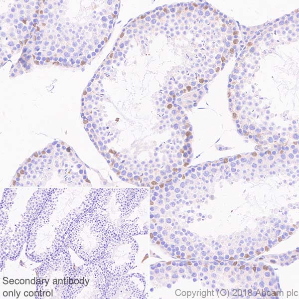 Immunohistochemistry (Formalin/PFA-fixed paraffin-embedded sections) - Anti-Wilms Tumor Protein antibody [SP320] - N-terminal (AB224801), expandable thumbnail