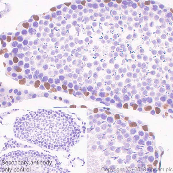 Immunohistochemistry (Formalin/PFA-fixed paraffin-embedded sections) - Anti-Wilms Tumor Protein antibody [SP320] - N-terminal (AB224801)