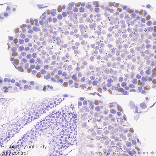 Immunohistochemistry (Formalin/PFA-fixed paraffin-embedded sections) - Anti-Wilms Tumor Protein antibody [SP321] (AB224806), expandable thumbnail