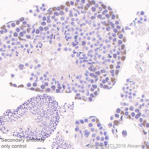 Immunohistochemistry (Formalin/PFA-fixed paraffin-embedded sections) - Anti-Wilms Tumor Protein antibody [SP321] (AB224806), expandable thumbnail