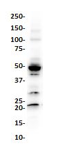 Western blot - Anti-Wilms Tumor Protein antibody [SP321] (ab224806), expandable thumbnail