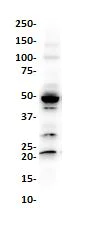 Western blot - Anti-Wilms Tumor Protein antibody [SP321] (AB224806)