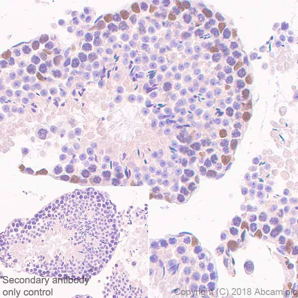Immunohistochemistry (Formalin/PFA-fixed paraffin-embedded sections) - Anti-Wilms Tumor Protein antibody [SP321] - BSA and Azide free (AB242425)