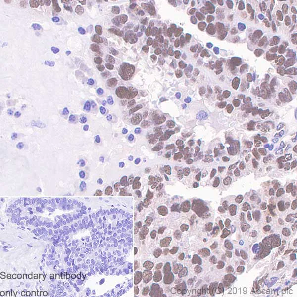 Immunohistochemistry (Formalin/PFA-fixed paraffin-embedded sections) - Anti-Wilms Tumor Protein antibody [SP321] - BSA and Azide free (AB242425)