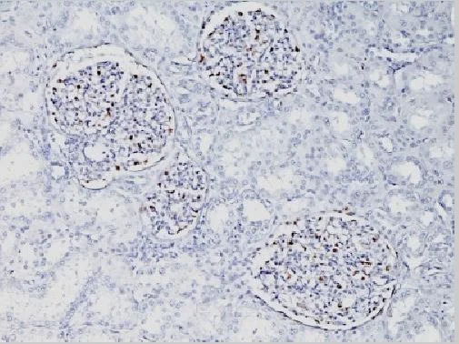 Immunohistochemistry (Formalin/PFA-fixed paraffin-embedded sections) - Anti-Wilms Tumor Protein antibody [WT1/857] (AB220212)