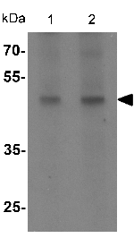 Western blot - Anti-WIPI1 antibody (AB139722), expandable thumbnail