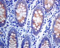Immunohistochemistry (Formalin/PFA-fixed paraffin-embedded sections) - Anti-WIPI1 antibody [EPR8110] - BSA and Azide free (AB248208)