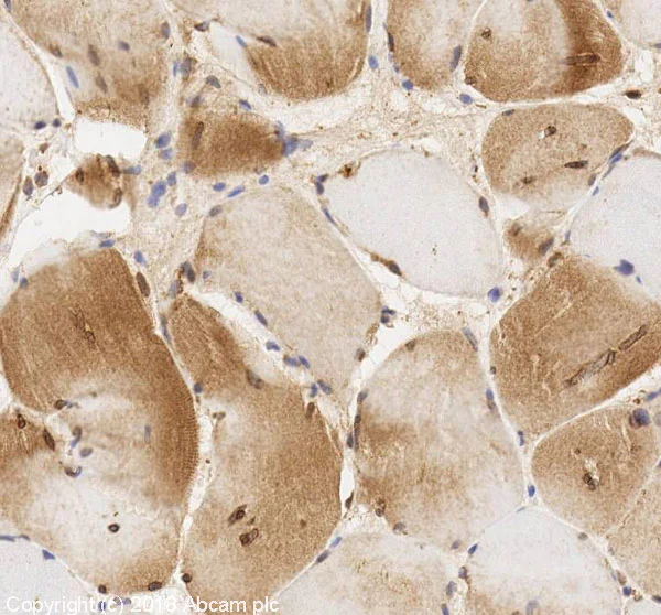Immunohistochemistry (Formalin/PFA-fixed paraffin-embedded sections) - Anti-WIPI2 antibody [2A2] (AB105459)